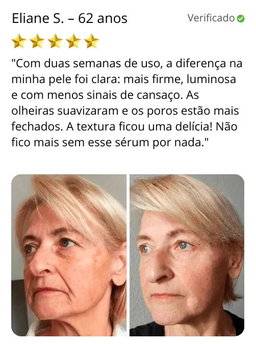 revitali_40